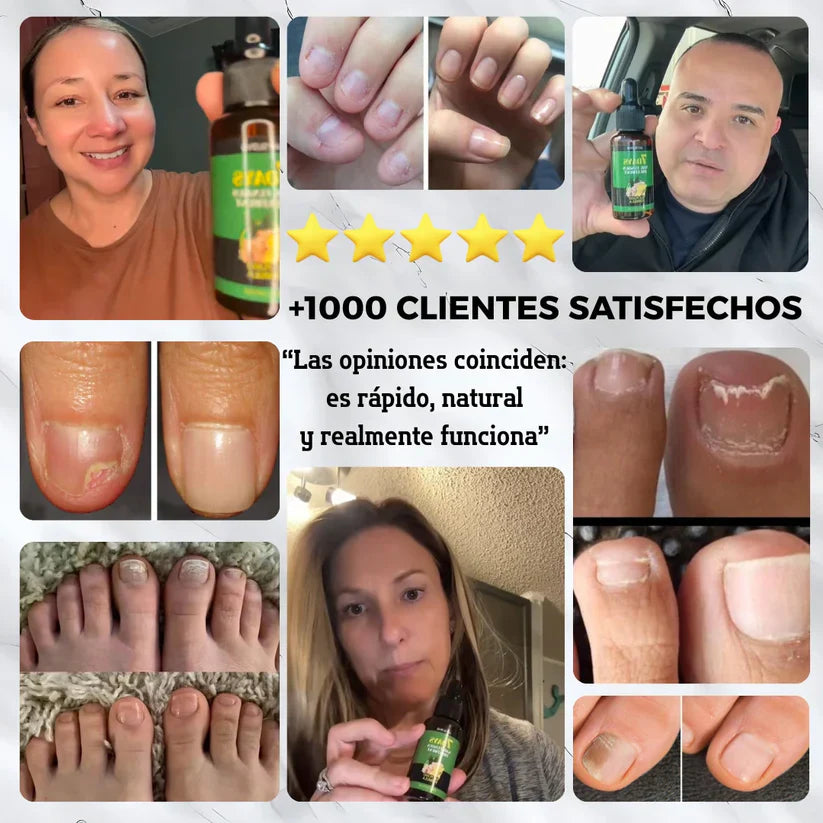 Clara‑Pure™ – Esencia Antihongos para Uñas