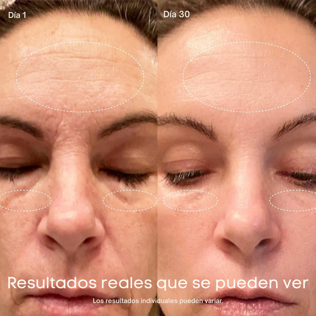 Varita SkinCare 4-en-1