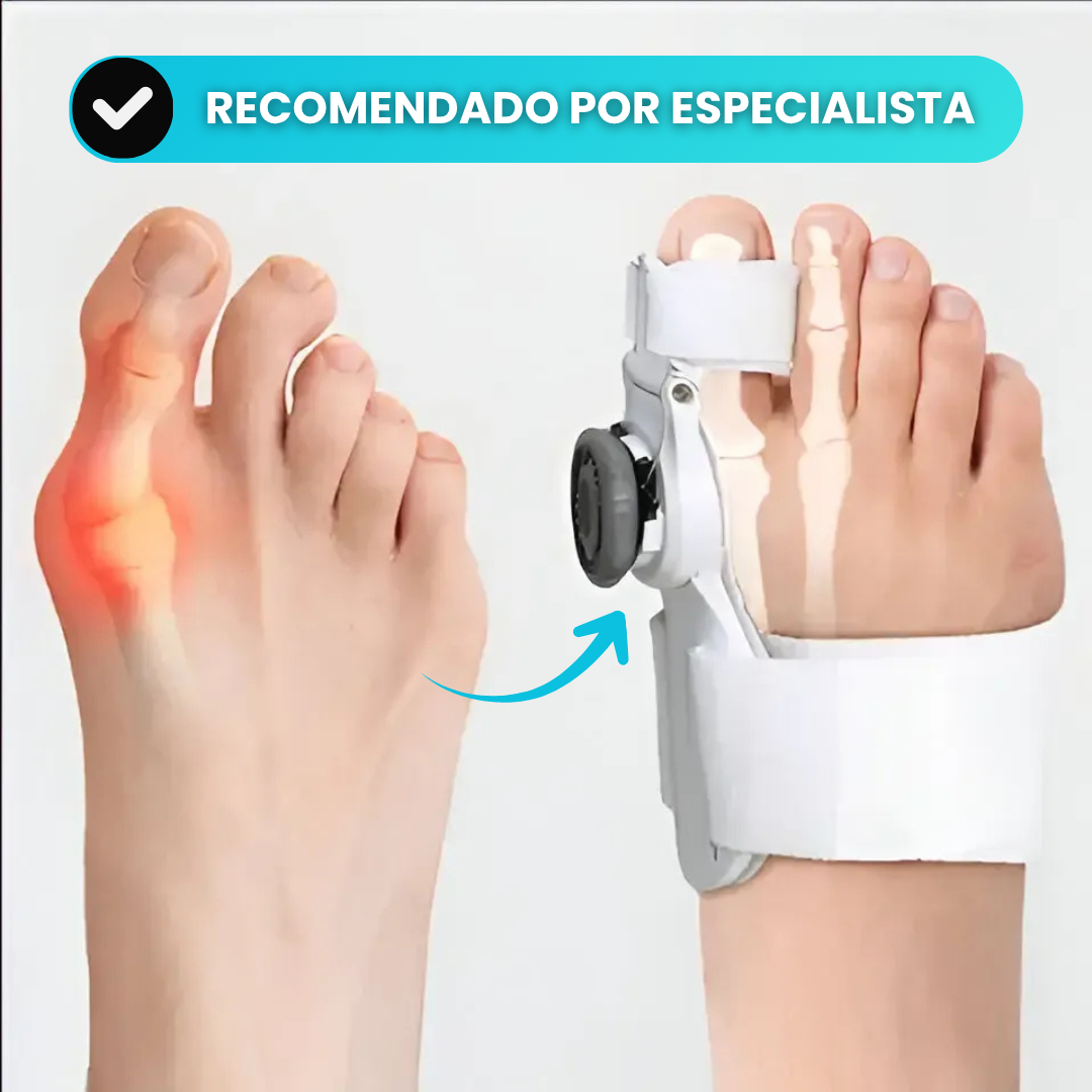 Corrector Plus™ – Alineador Ortopédico para Juanetes | Alivia el Dolor y Corrige sin Cirugía