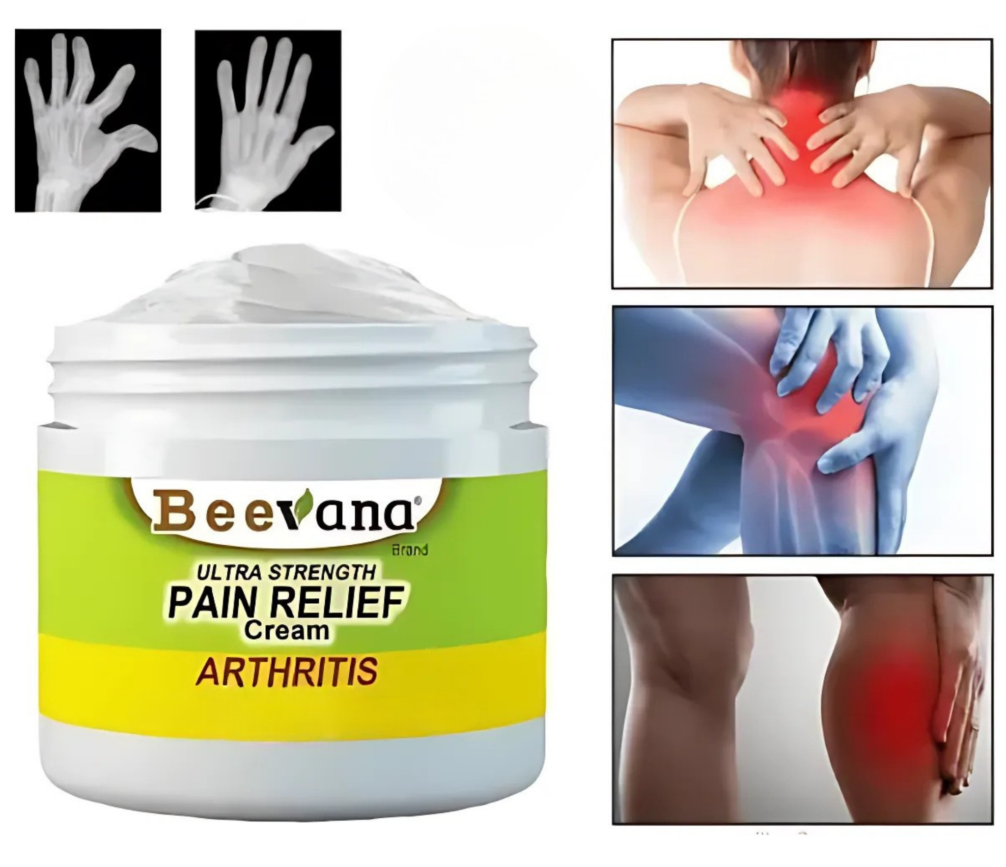 Crema Ultra Fuerte de Alivio Rápido – Dolor de Articulaciones y Músculos