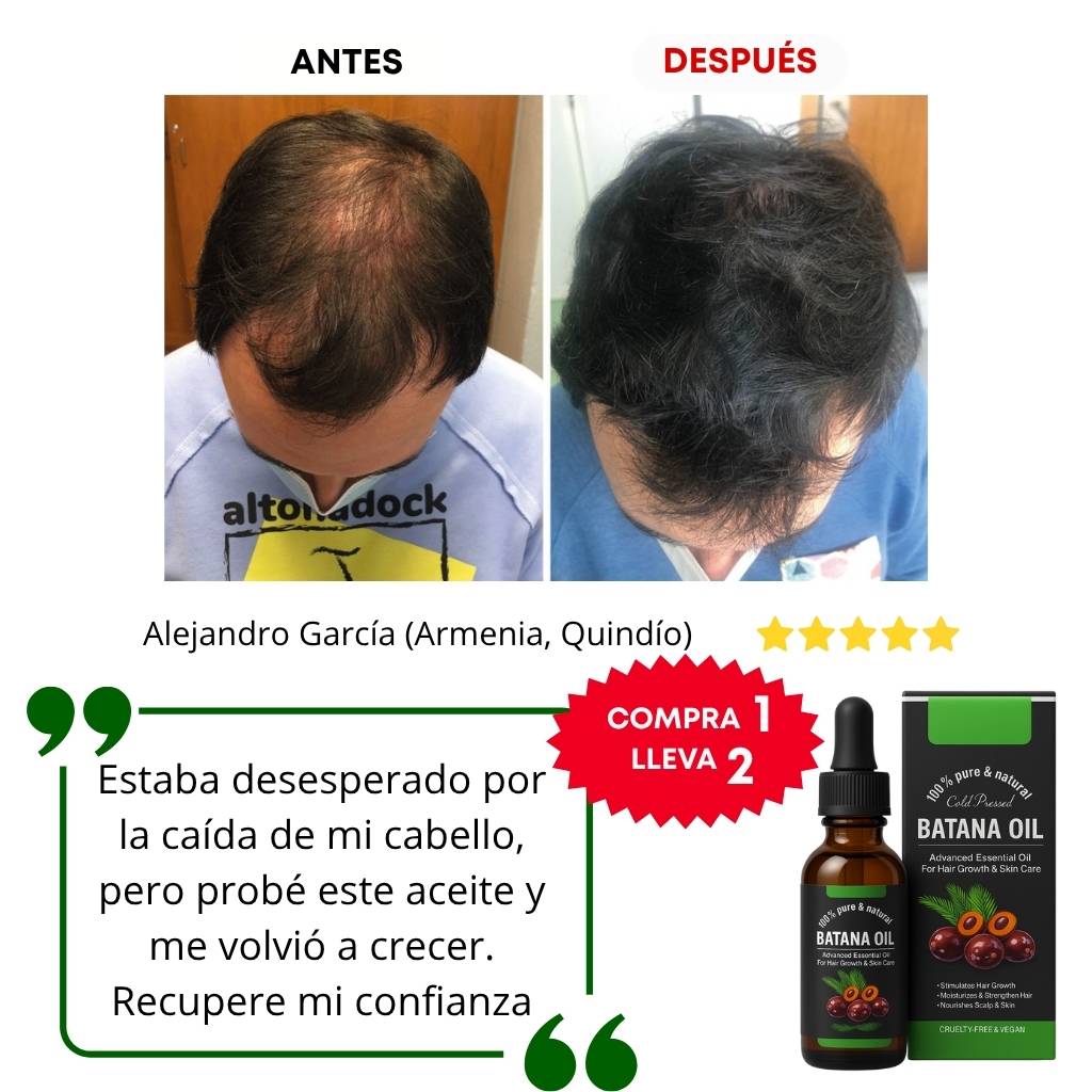 Aceite Batana: El Secreto Ancestral para Prevenir la Caída del Cabello y Estimular el Crecimiento