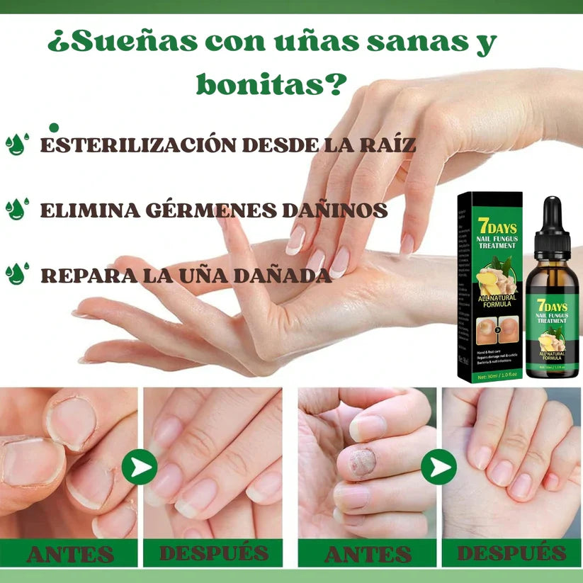 Clara‑Pure™ – Esencia Antihongos para Uñas