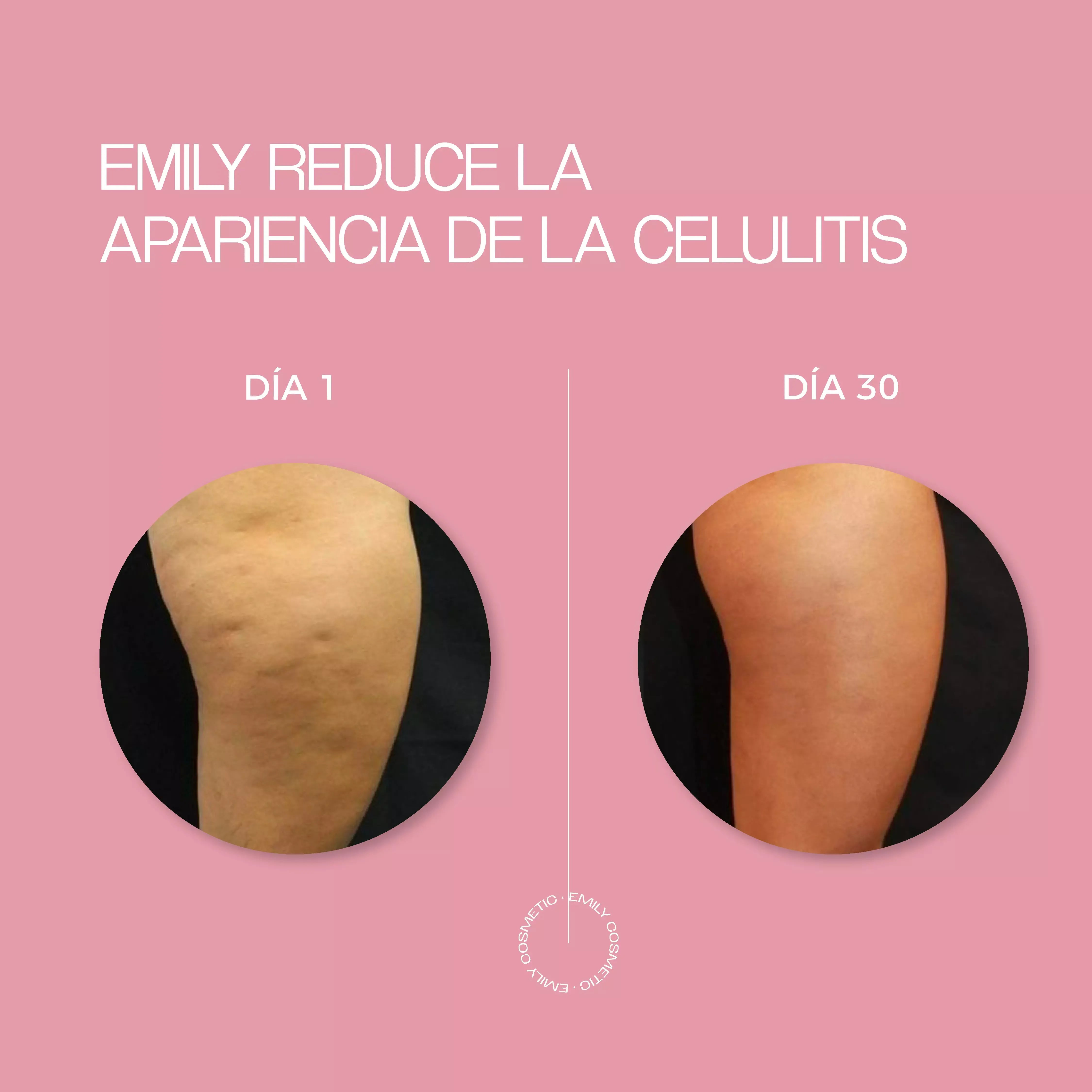 Crema Anticelulitis con Centella y Vitamina E